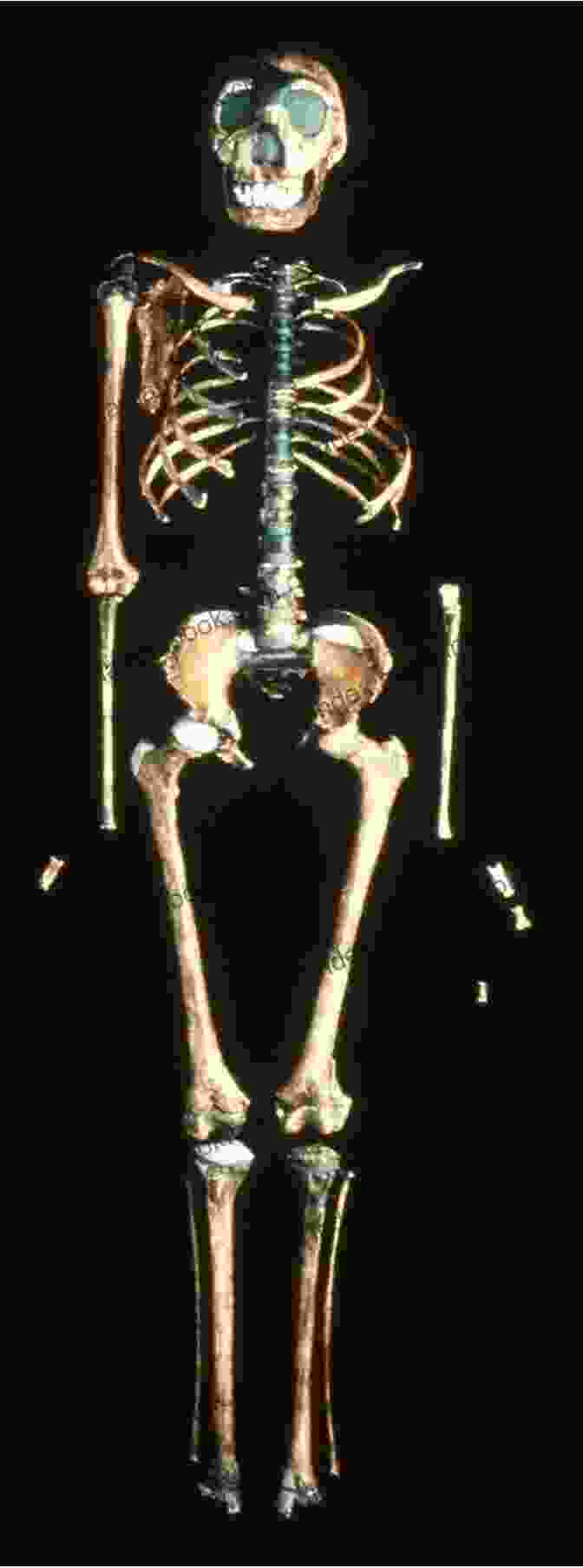 An Image Of The Reconstructed Skeleton Of The Dorset Boy The Trojan Horse: The Dorset Boy 7